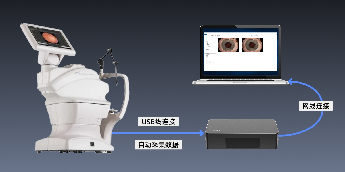 眼底照相机NW400
